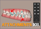 M.O.C.A. 101 - Clear Aligner Principles (45 CE) The C.L.E.A.R. Institute