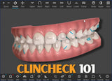 M.O.C.A. 101 - Clear Aligner Principles (45 CE) The C.L.E.A.R. Institute