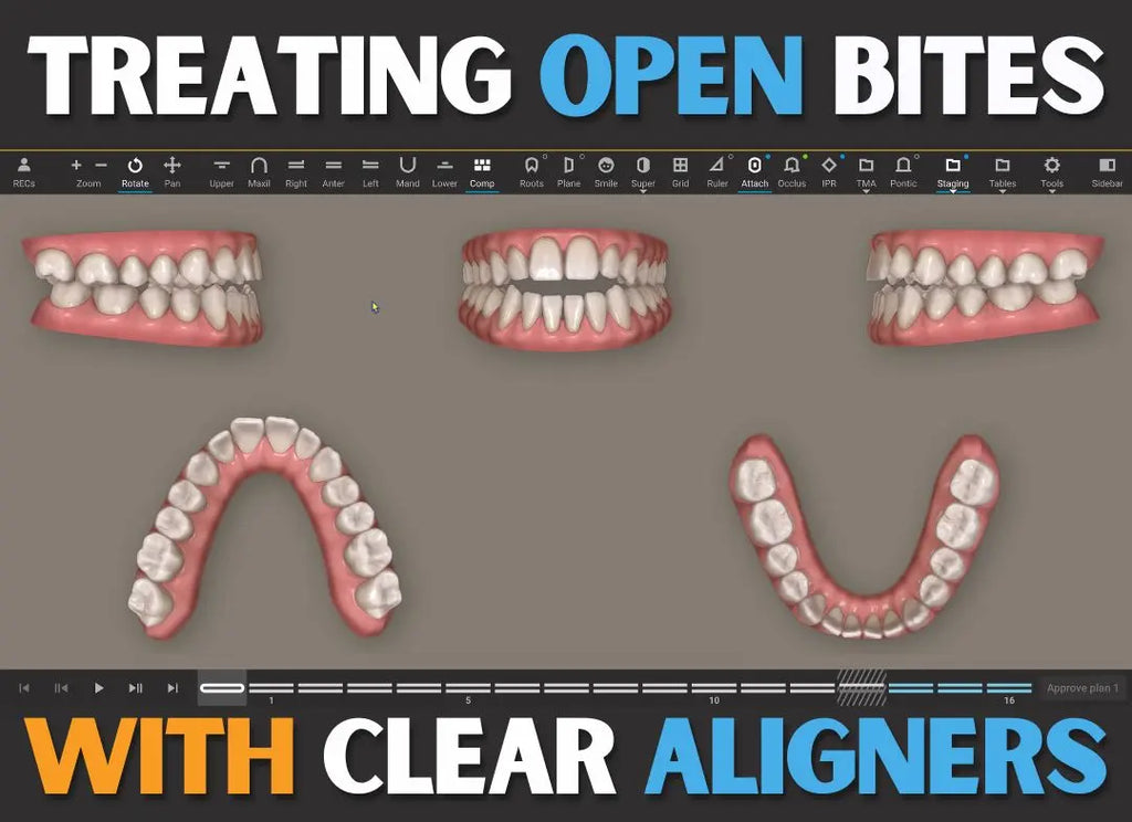 M.O.C.A. 201 - Mastering Clear Aligners (45 CE) The C.L.E.A.R. Institute