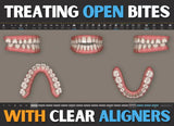 M.O.C.A. 201 - Mastering Clear Aligners (45 CE) The C.L.E.A.R. Institute
