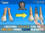 M.O.C.A. 101 - Clear Aligner Principles (45 CE) The C.L.E.A.R. Institute
