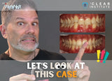 M.O.C.A. 101 - Clear Aligner Principles (45 CE) The C.L.E.A.R. Institute